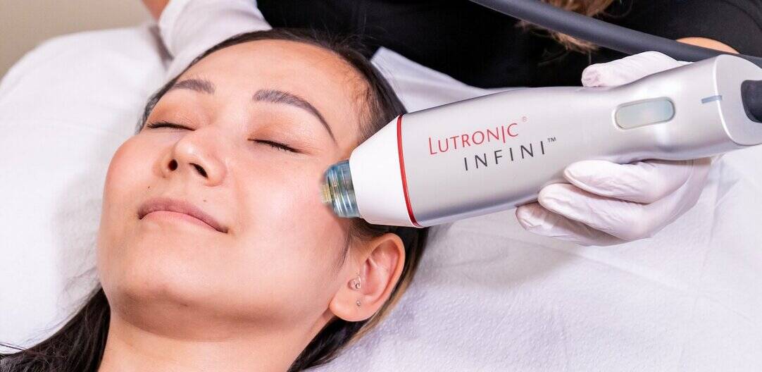 Surrey RF Microneedling (Vancouver) | Collagen Induction Therapy